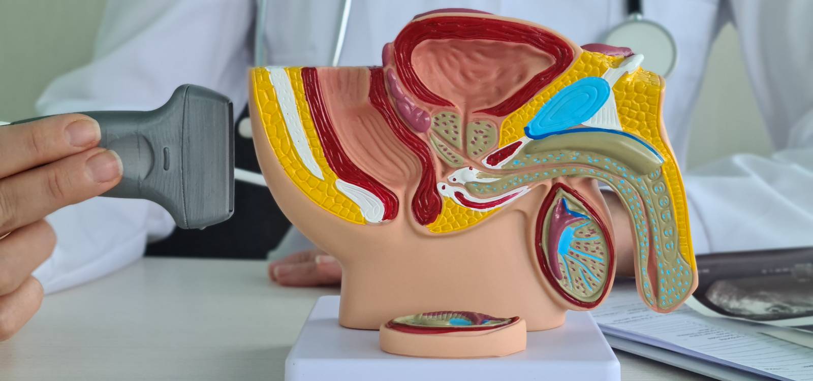 Prostate Problems treated at Tracey Miles Physio near Canterbury Kent